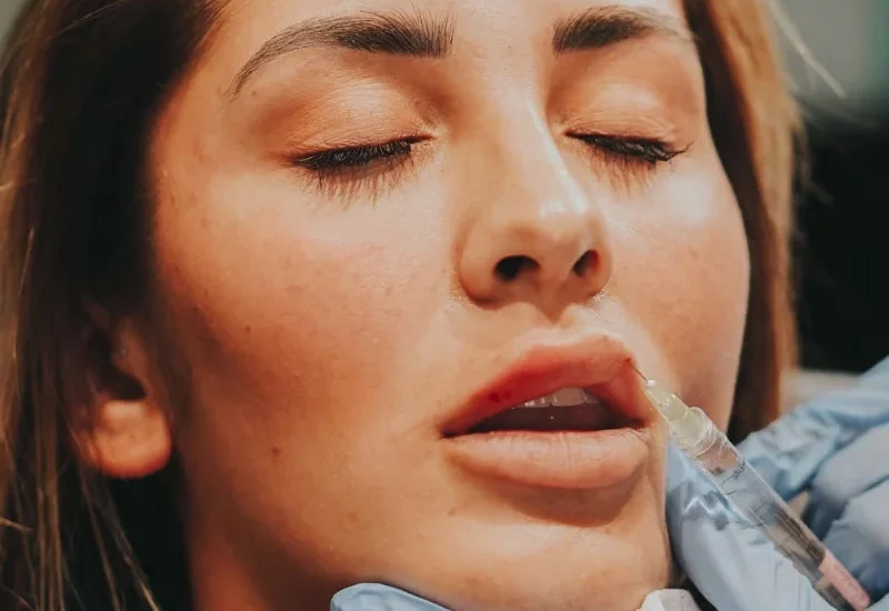 lip-enhancement-the-laser-lounge-spa-estero-fl.webp